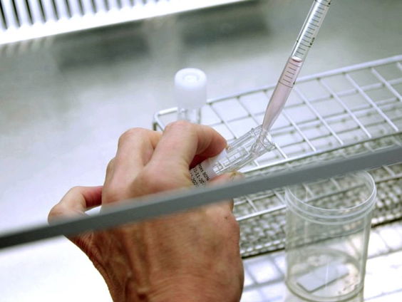 Waarom willen gynaecologen af van buitenlandse spermadonoren?