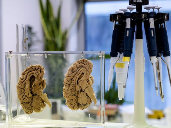 Veertig jaar Nederlandse Hersenbank: wat was de aanleiding om de bank te beginnen?