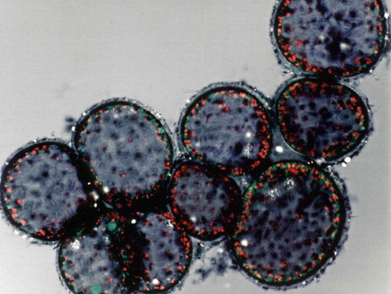 Van veldslag tot ziekenhuis: de eeuwige strijd tegen bacteriën