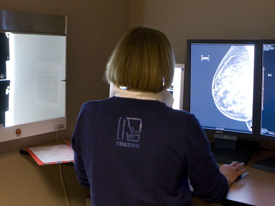 AI verbetert borstkankerdiagnose in Nederland