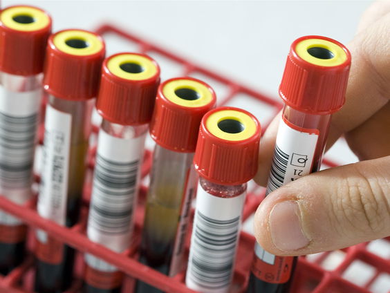 Persoonlijk eetadvies op basis van jouw lichaam: 'Zit veel potentie in'