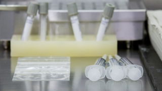 Het belang van pathologisch onderzoek: 'Het wordt snel afgedaan als een nat ...