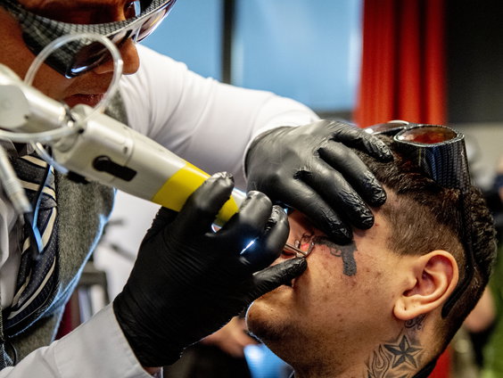 Actie om gedwongen tatoeages te verwijderen bij vrouwen