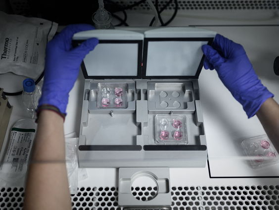 Maastrichtse onderzoekers ontdekken hoe een eeneiige tweeling ontstaat