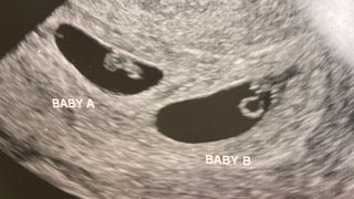 Draait het CDA over embryo-onderzoek?