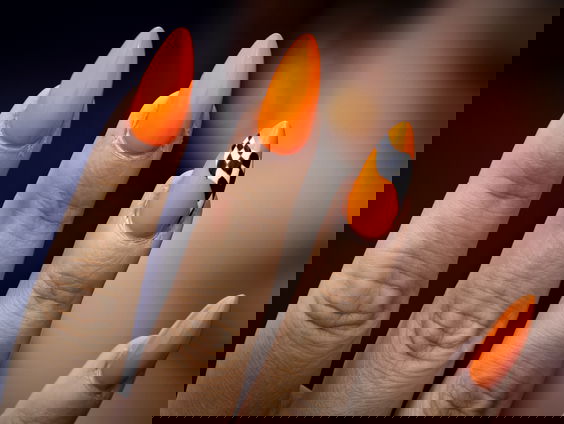 Artsen zien toename aantal mensen met allergische reactie op gellak