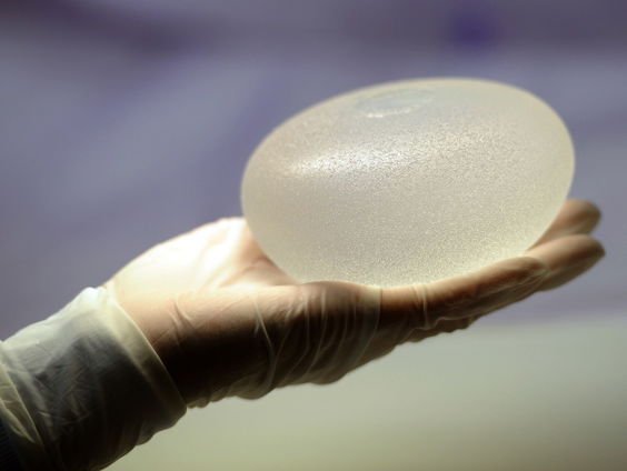 Massaclaim tegen borstimplantatenbedrijf AbbVie van start