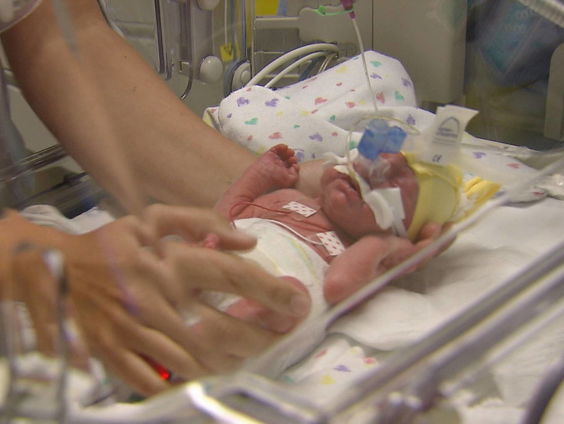 Amerikaans onderzoek toont succes van gentherapie bij baby's met SCID