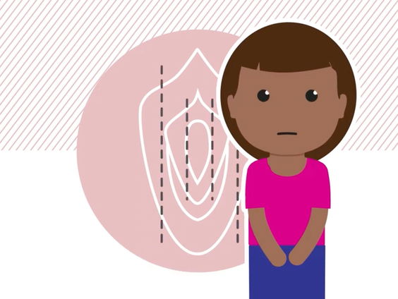 Genitale verminking al tien jaar strafbaar, toch zien gynaecologen slachtoffer in Nederland