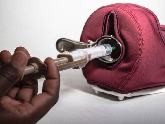 Hoe een uitvinding van 1 euro gynaecologische ingrepen voor miljoenen vrouwen minder pijnlijk kan maken