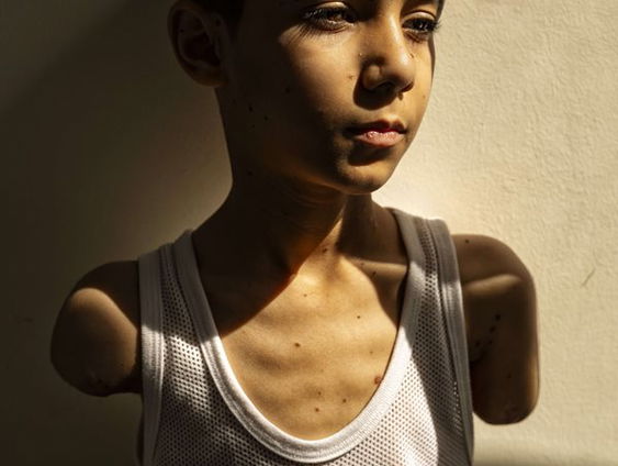 Foto 9-jarige jongen Mahmoud uit Gaza wint World Press Photo