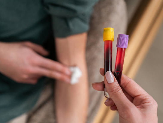 Bloedbank Sanquin stopt met alle commerciële activiteiten vanwege financiële problemen