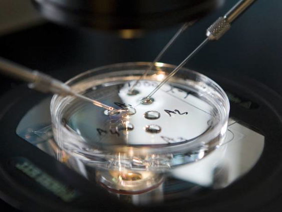 Kamerdebat over het kweken van menselijke embryo’s