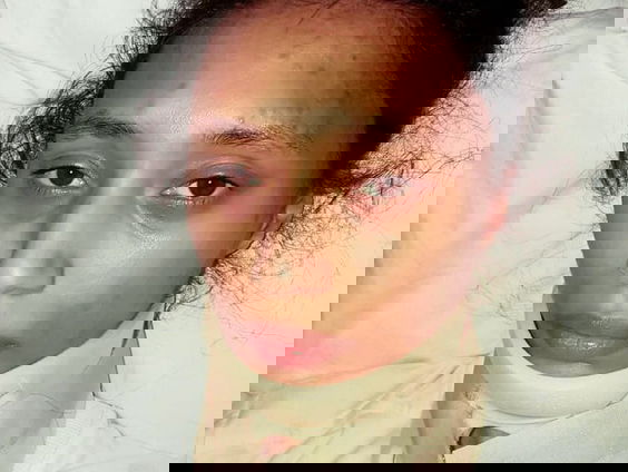 Ruby (25) heeft een speciale aandoening en kan niet meer zelfstandig leven!