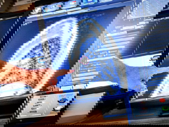 Campagne voor ziekte Primaire Tumor Onbekend (PTO)