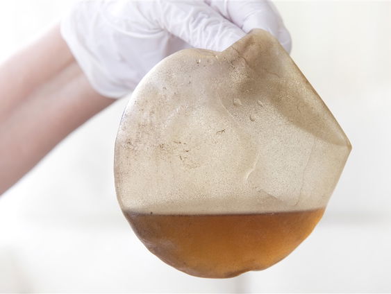 Rechtszaak tegen borstimplantaten-fabrikant Allergan van start: 6.000 vrouwen verenigen zich