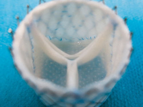 Nederlandse onderzoekers ontwikkelen een nieuwe biomechanische hartklep