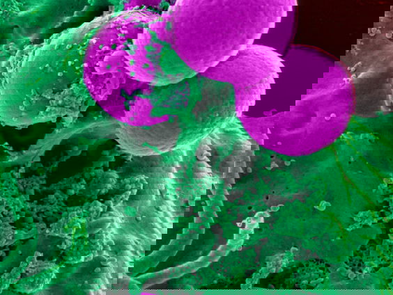 Wat we kunnen leren van mislukte onderzoeken