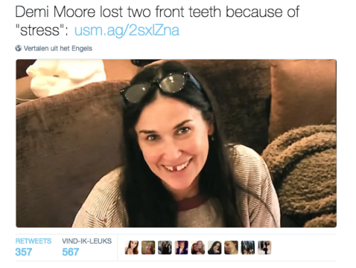 FoF: Tanden verliezen door stress