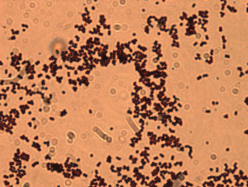 Vieze radio 1-plopkappen nader onderzocht