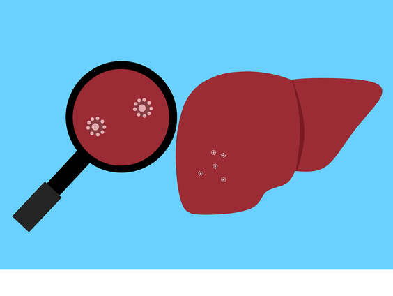 De conditie van patiënten met levercirrose