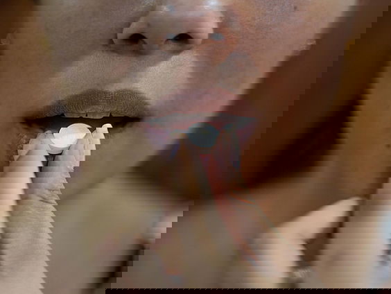 MDMA voor behandeling PTSS bij jongeren