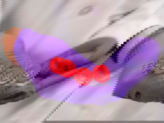 Gezondheidsraad: hpv-zelftest voor alle vrouwen