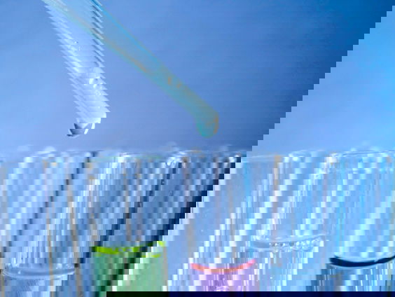 Werkgevers mogen ten alle tijden een drugstest afnemen bij werknemers