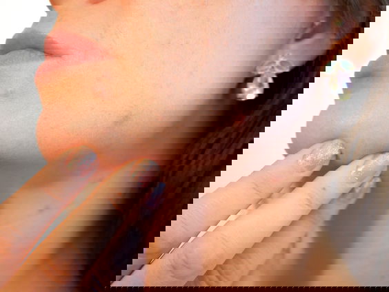 Ik durf het bijna niet te vragen! Puisten.