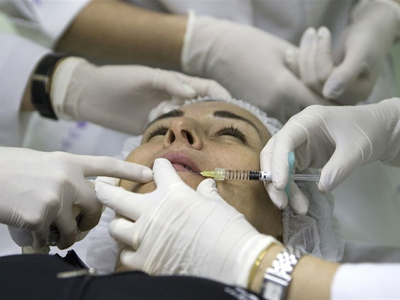 De keerzijde van botox en fillers bij jongeren
