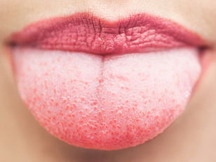 Een pet met een platte klep is een platte kleppet.. en nog veel meer tongbrekers!