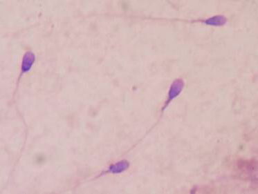 Zaadkwaliteit van de westerse man keldert