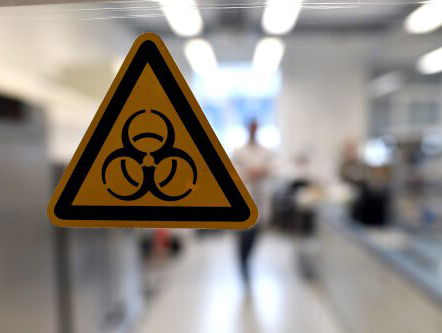 Zwembaden en sauna's ontkennen legionellabesmetting