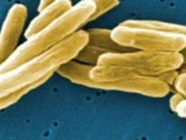 Hoe bestrijden we tuberculose?