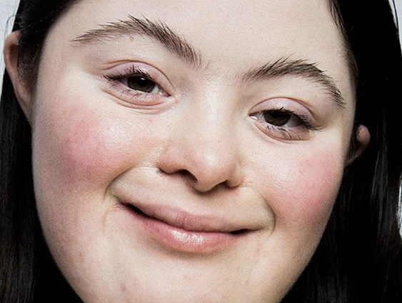 Gucci-model met syndroom van Down