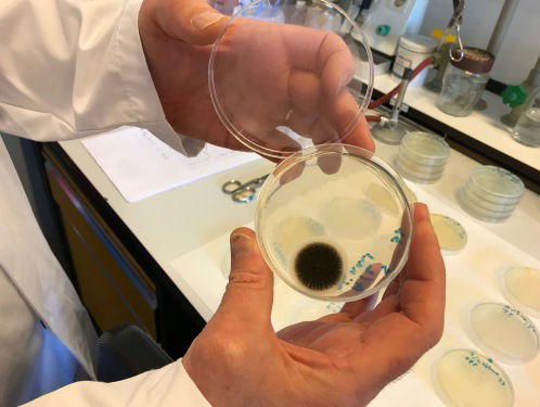 Onze Radio 1-plopkappen zitten vol bacteriën en schimmels