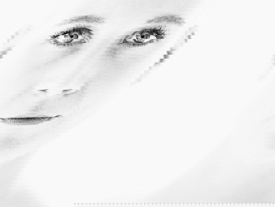 Sandra verloor in 4 dagen al haar haren