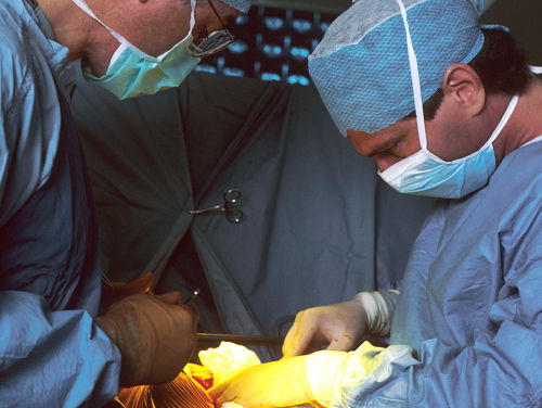 Nieuwe projector helpt bij borstreconstructie met eigen weefsel