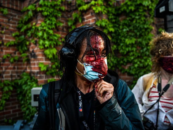 Aanval op journalisten in de VS