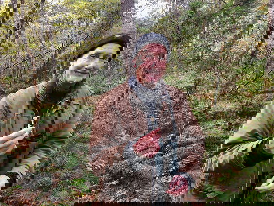 De opperarmbeentjes van Hans Donkers