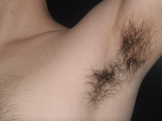 Waarom heb ik okselhaar?