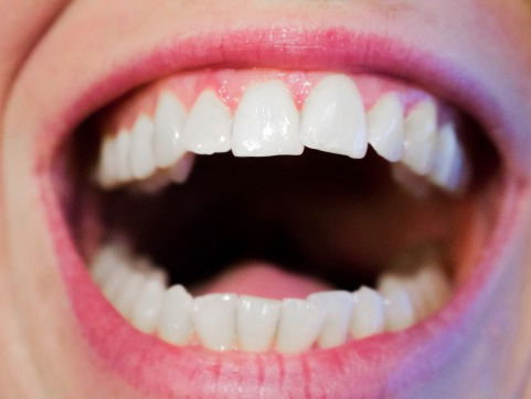 10 tips voor een frisse adem