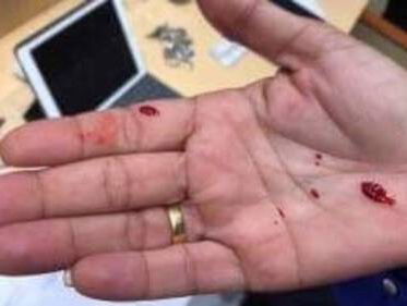 Curaçaose parlementariër slaat collega in gezicht