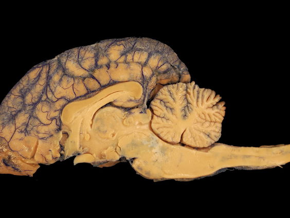 Beter eten in plaats van psychiatrische pilletjes