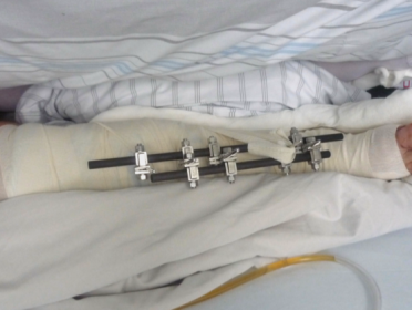 Letselschadeadvocaten: strijd met verzekeraars verhardt