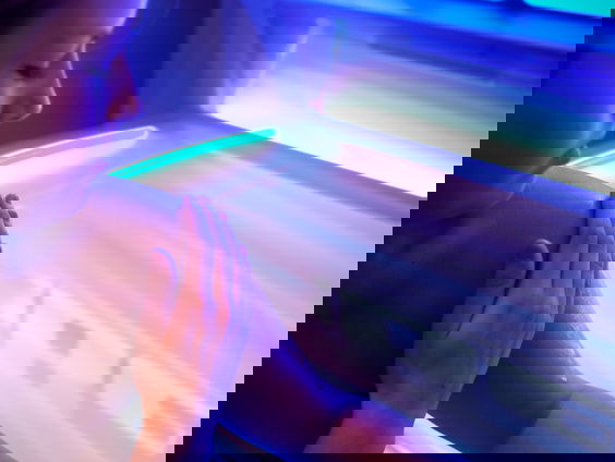 Isabel kreeg huidkanker en waarschuwt nu andere jongeren voor de gevaren van onbeschermd zonnen