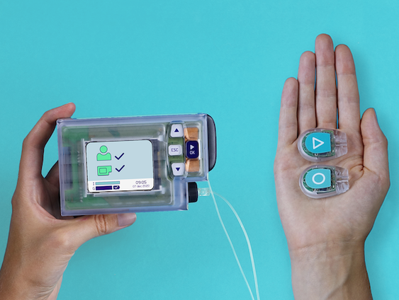 De kunstmatige alvleesklier neemt de zorg van mensen met diabetes type 1 uit handen