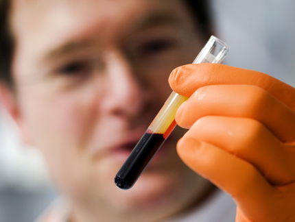 Belangrijke stap richting bloedtest die kanker opspoort