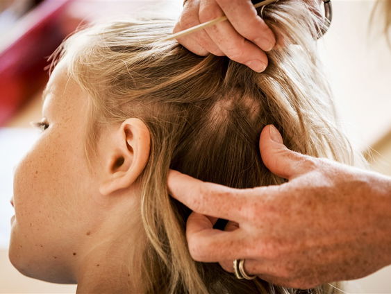 Tips om hoofdluis te voorkomen en bestrijden: 'Knuffels en kleding in de was niet nodig'