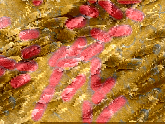 Microbiologen slaan alarm: resistente bacteriën reizen mee vanuit Afrika en Azië